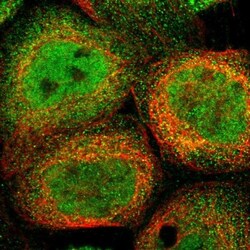 SELM Antibody, Novus Biologicals 0.1mL; Unlabeled:Antibodies, Polyclonal